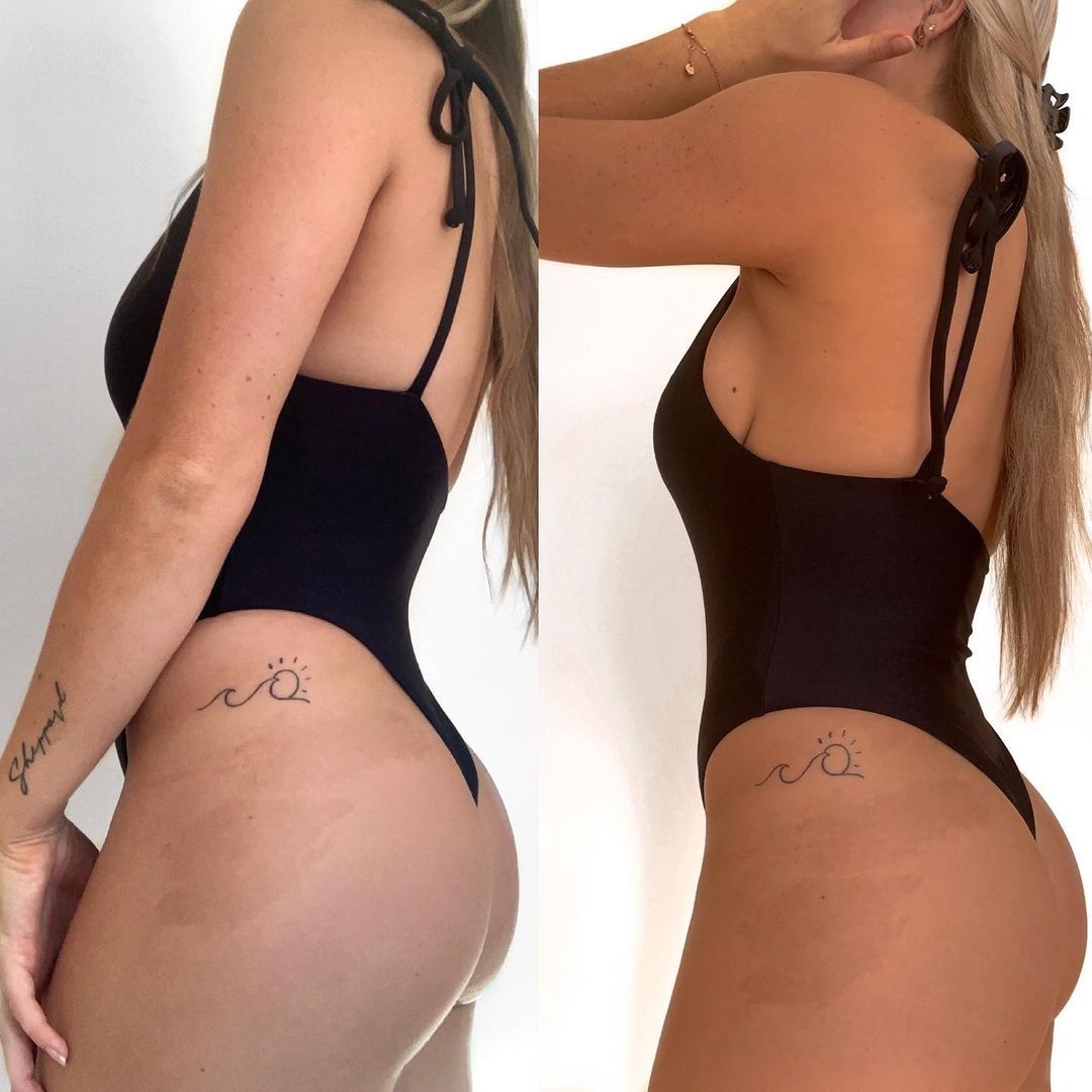 LUME – Cápsulas Bronceadoras Naturales